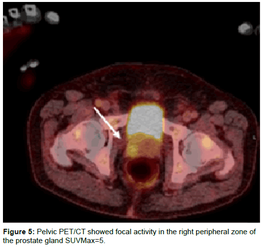 radiology-right-peripheral-zone