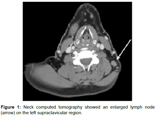 radiology-supraclavicular-region