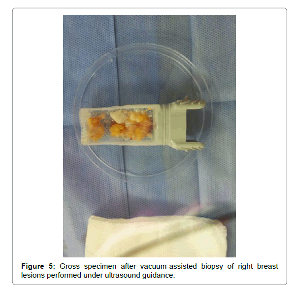 radiology-ultrasound-guidance