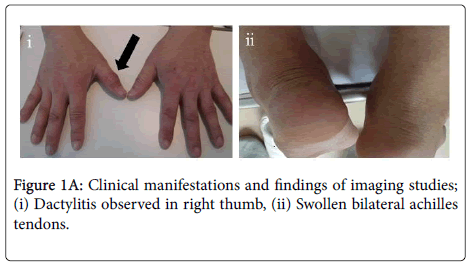 rheumatology-Clinical-manifestations