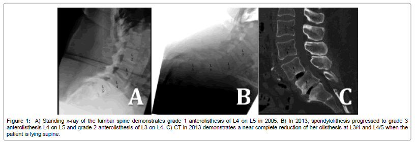 Lumbar X Ray Technique