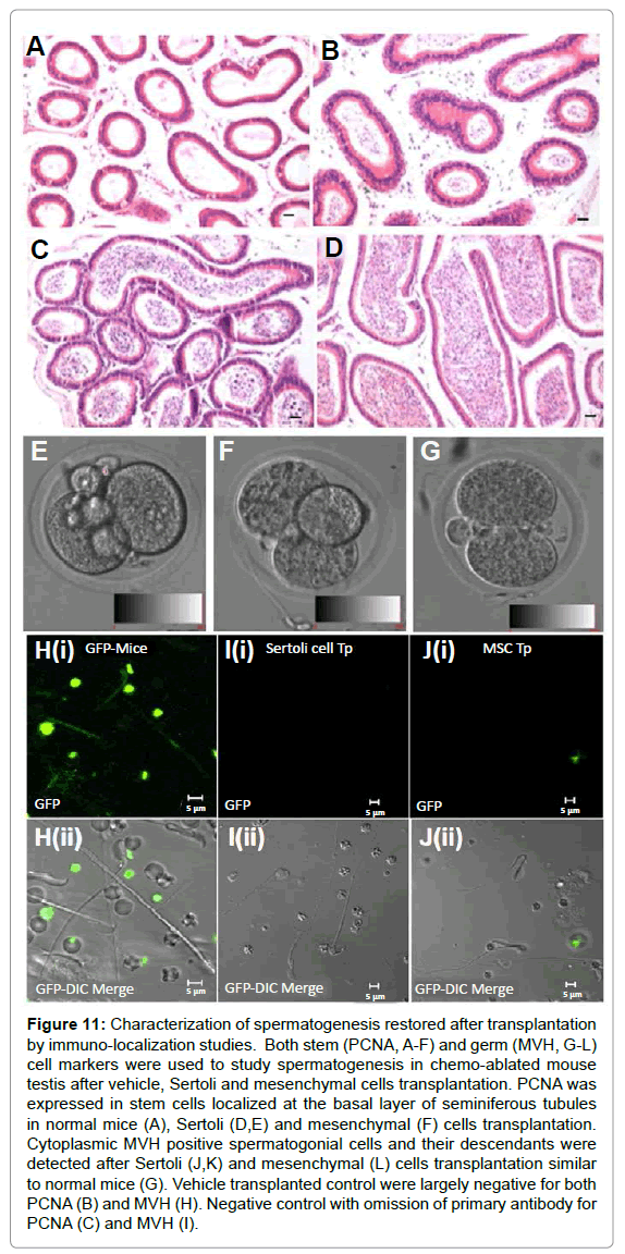 stem-cell-research-therapy-study-spermatogenesis