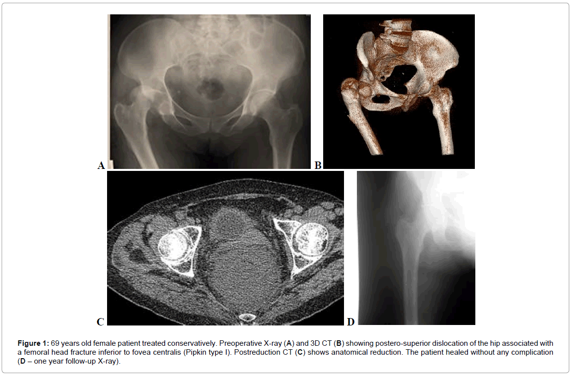 Surgery-69-years-treated-conservatively