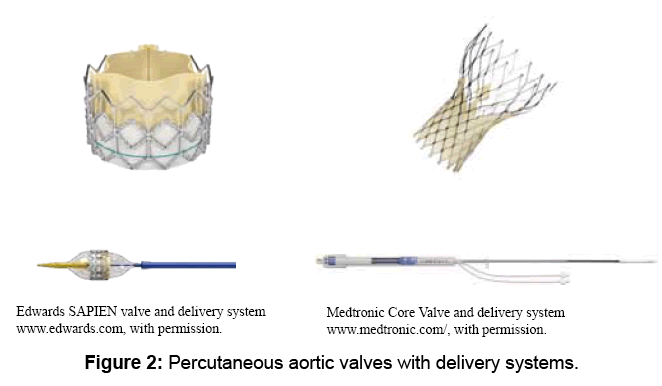 Cardiac Surgery: Current Status of Aortic Valve Replacement | OMICS ...