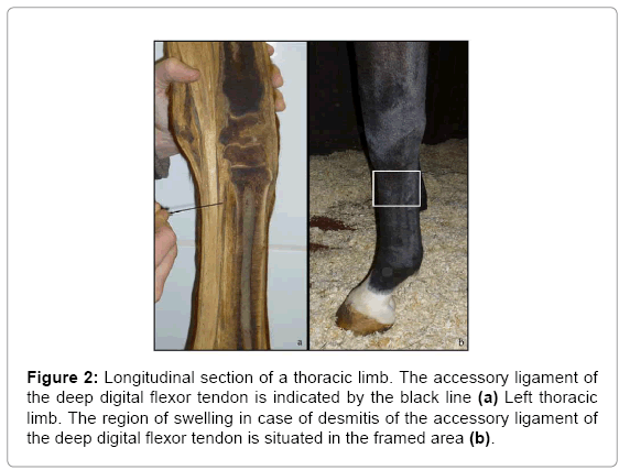 Digital Flexor Tendon Sheath