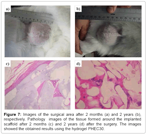 tissue-science-engineering-tissue-formed-around