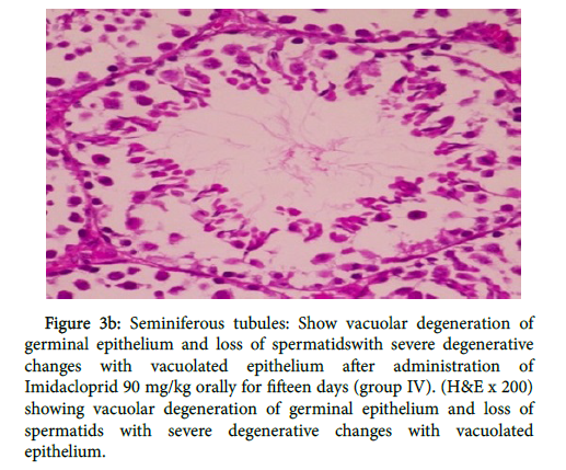 toxicology-Seminiferous-tubules