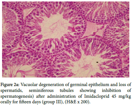 toxicology-Vacuolar-degeneration