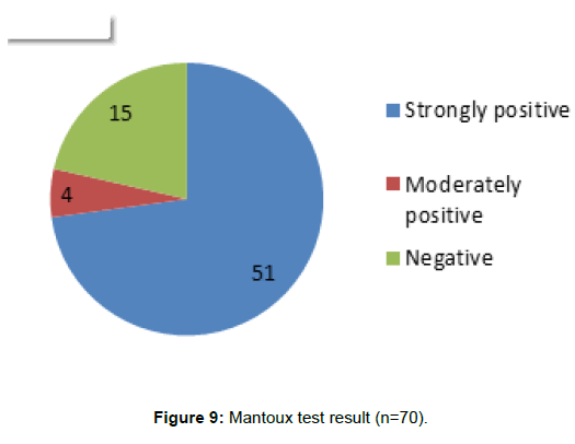 tuberculosis-therapeutics-mantoux-test-result