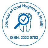 Resin Infiltration Of Non Cavitated Proximal Caries Lesions A Literature Review