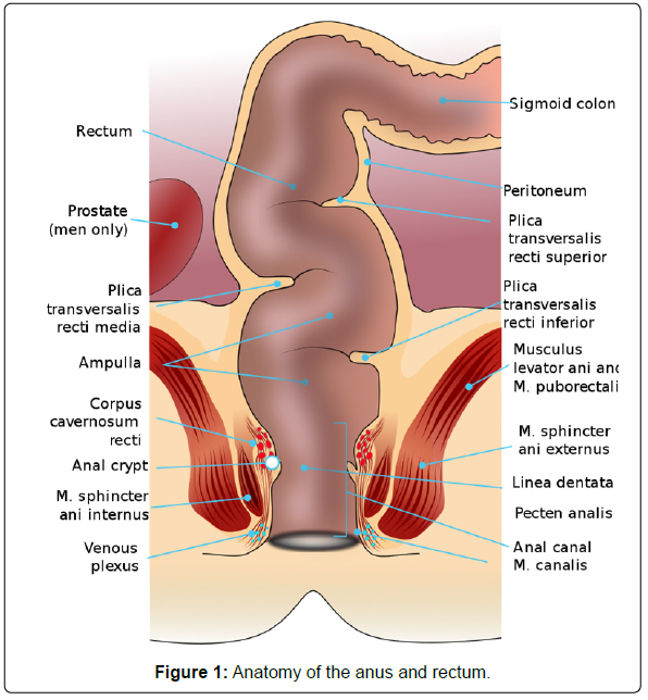 Anal Thrombosis - Clinical Pharmacology & Biopharmaceutics - Rectal Drug Delivery System: An  Overview