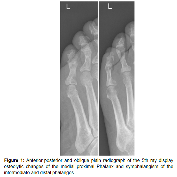 Clinical Research Foot Ankle Posterior
