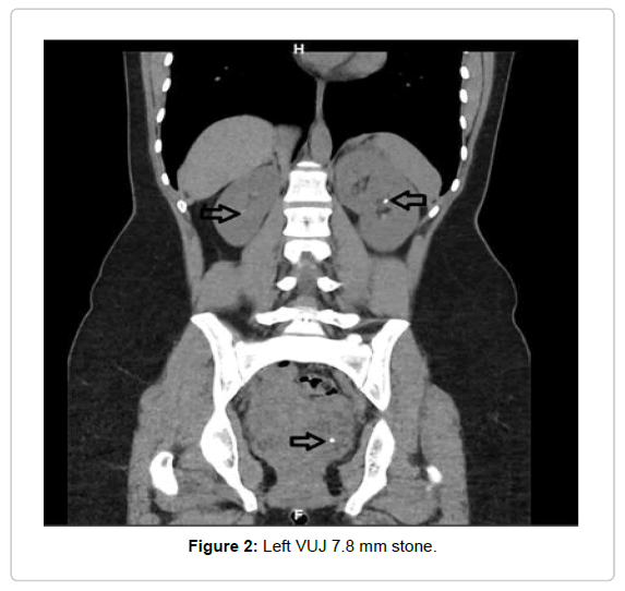 Clinical-Case-VUJ