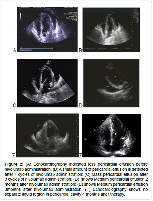 clinical-case-reports-Echocardiography