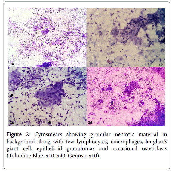 cytology-histology-necrotic-material