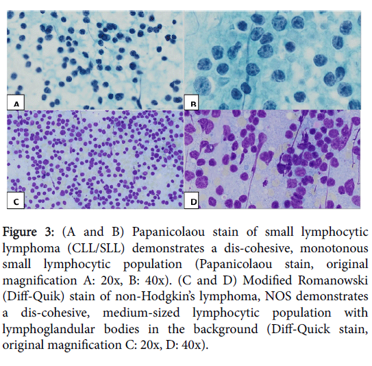 Cytology-histology-papanicolaou-stain