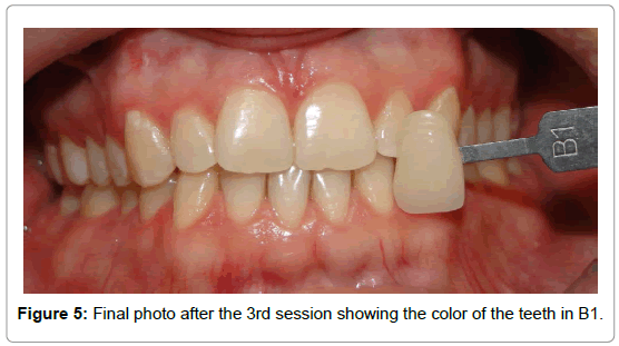 dentistry-session-showing