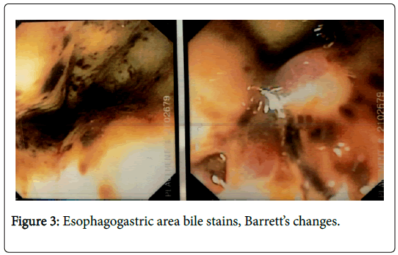 gastrointestinal-digestive-area-bile-stains