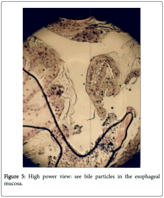 gastrointestinal-digestive-see-bile-particles