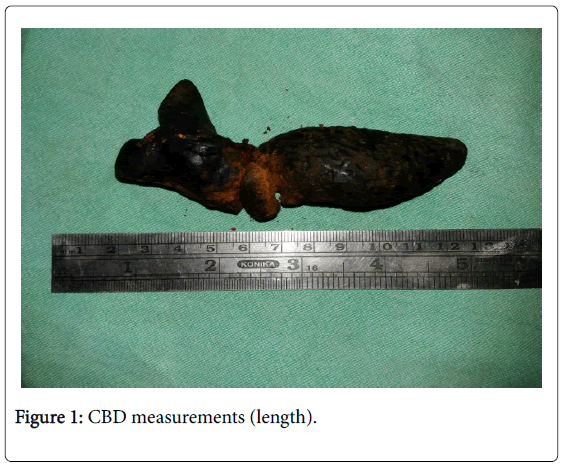 gastrointestinal-digestive-system-CBD-measurements-length