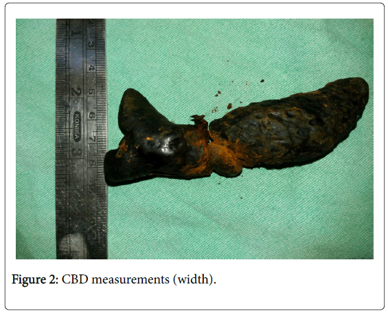 gastrointestinal-digestive-system-CBD-measurements-width