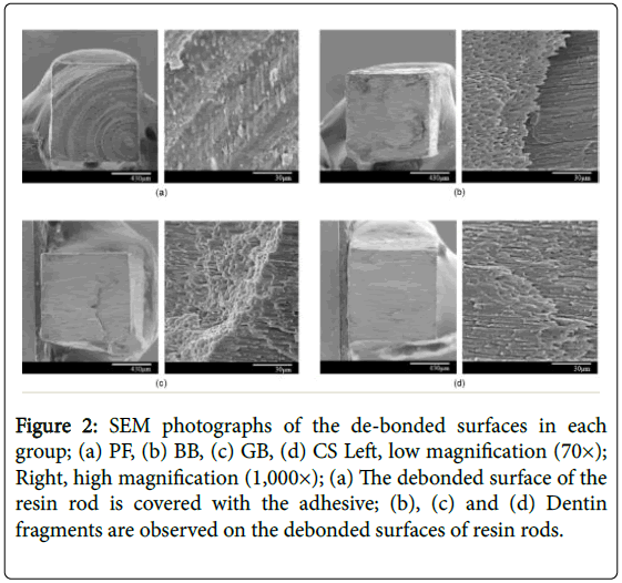 interdisciplinary-medicine-dental-science-photographs-bonded-surfaces