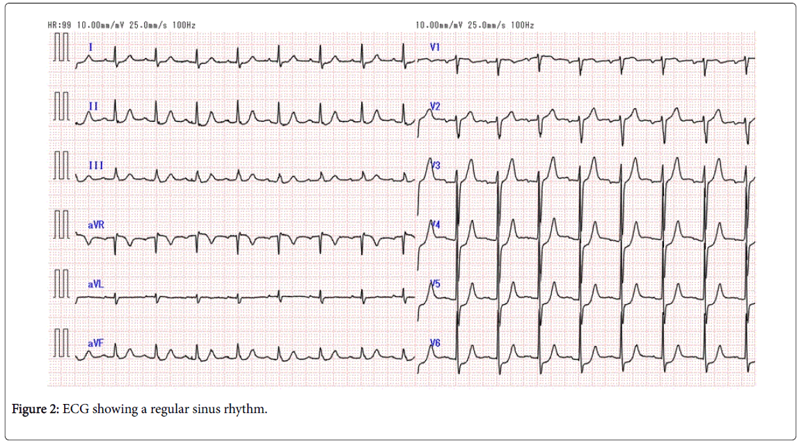 medical-reports-case-studies-ECG-sinus-rhythm