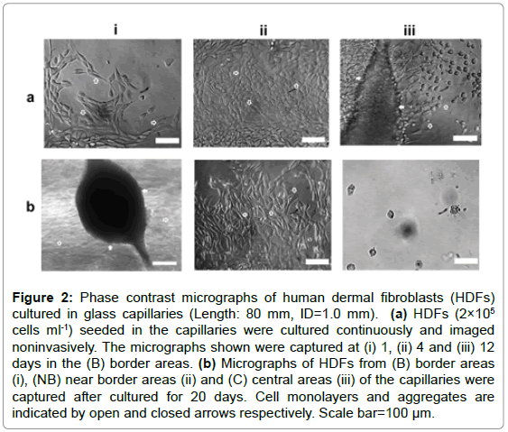 microscopy-human-dermal-fibroblasts