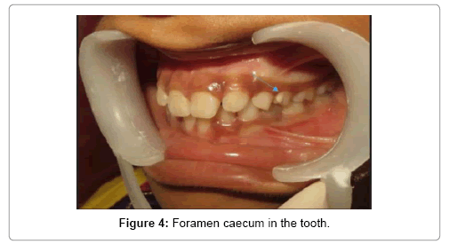 morphology-anatomy-tooth