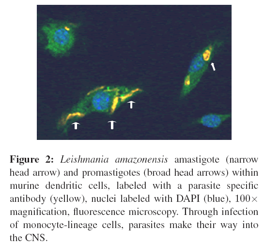 neuroinfectious-diseases-Leishmania-amazonensis