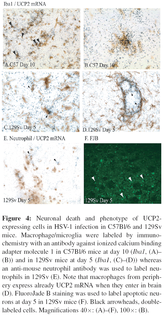 neuroinfectious-diseases-Neuronal-death