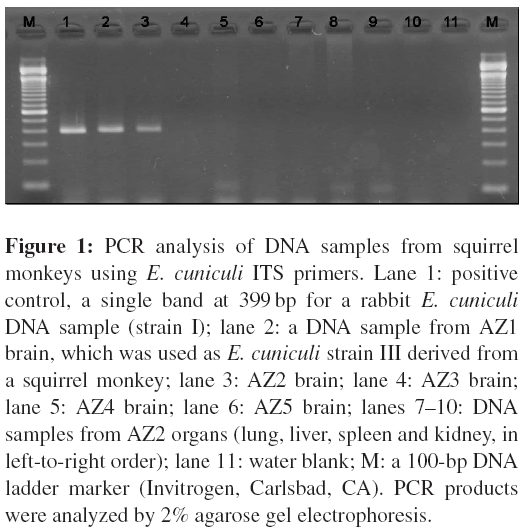 neuroinfectious-diseases-PCR-analysis