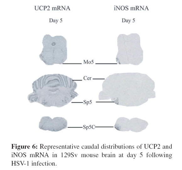 neuroinfectious-diseases-Representative-caudal