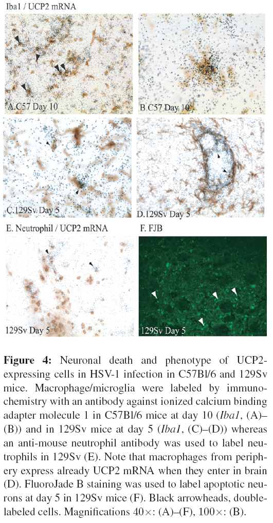 neuroinfectious-diseases-Representative-rostrocaudal