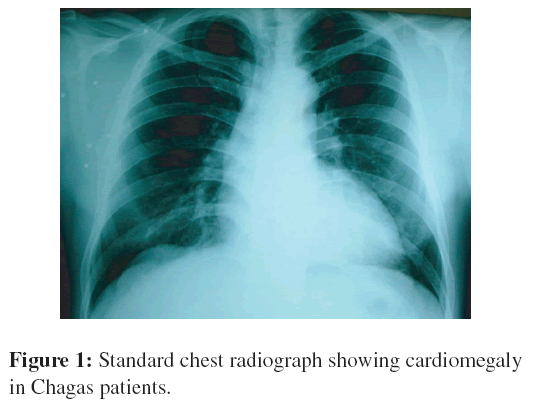 neuroinfectious-diseases-Standard-chest