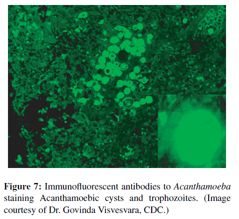 neuroinfectious-diseases-antibodies