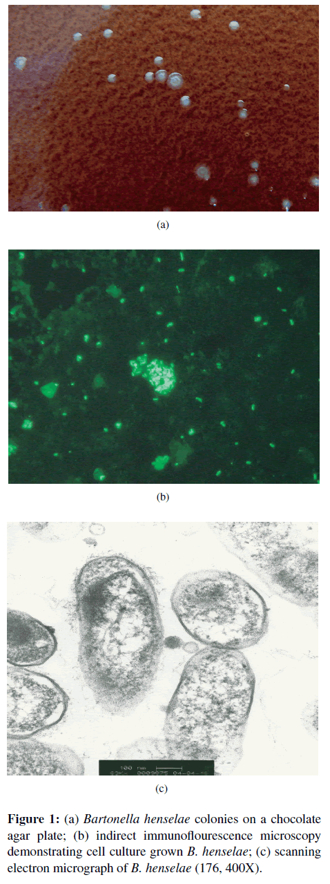 neuroinfectious-diseases-chocolate