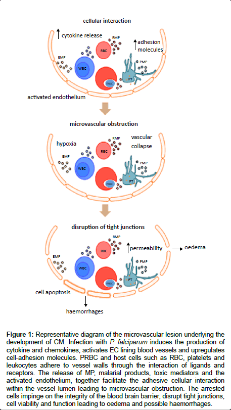 neuroinfectious-diseases-microvascular-lesion-underlying