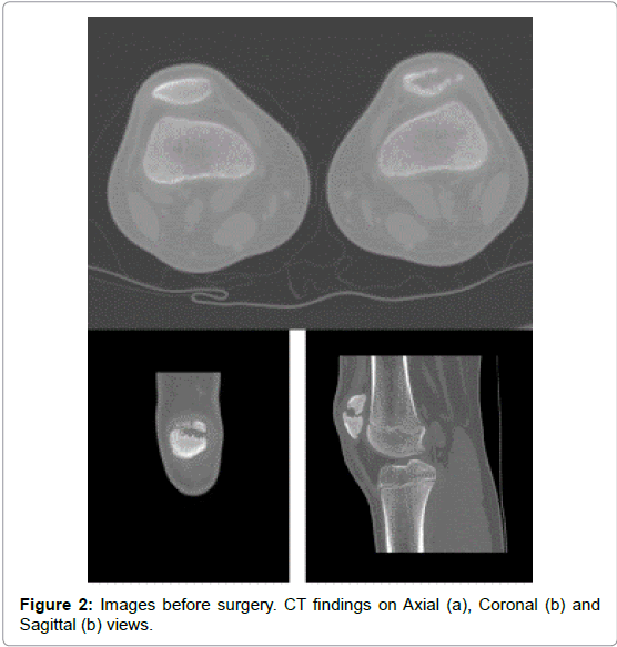 orthopedic-oncology-Sagittal-views