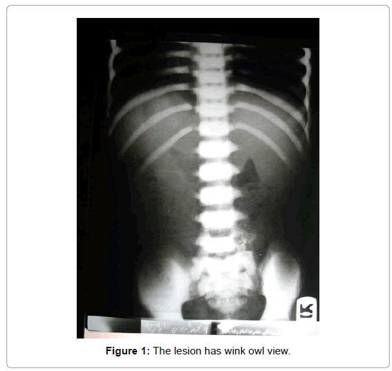 orthopedic-oncology-wink-owl-view