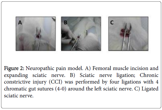 pain-relief-Neuropathic-pain-model
